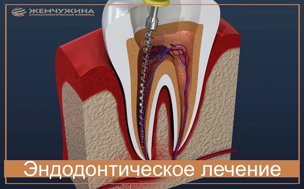 Лечите зубы с удовольствием в стоматологии 